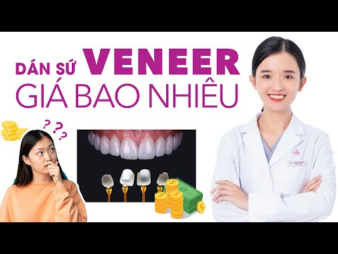 Video: Beacon cho thạch cao - đảm bảo chất lượng bề mặt