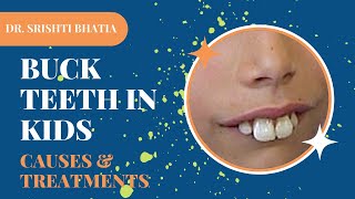 Buck Teeth in Kids- Causes & Treatment; Dr. Srishti Bhatia