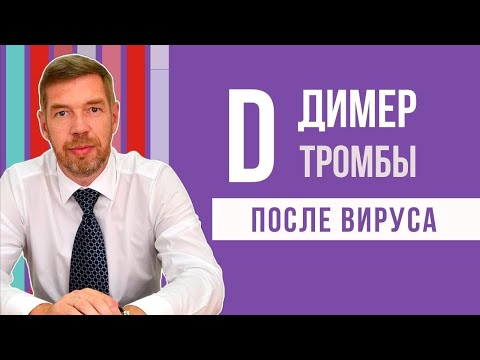 Видео: Нормално ли е димерът да бръмчи?