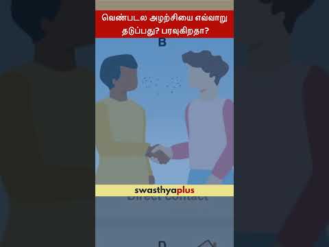 வெண்படல அழற்சியை எவ்வாறு தடுப்பது? பரவுகிறதா? | Prevention of Conjunctivitis | Dr Amudha Raghupathy