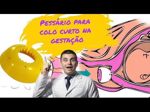 Vídeo: Faça você mesmo pessário?