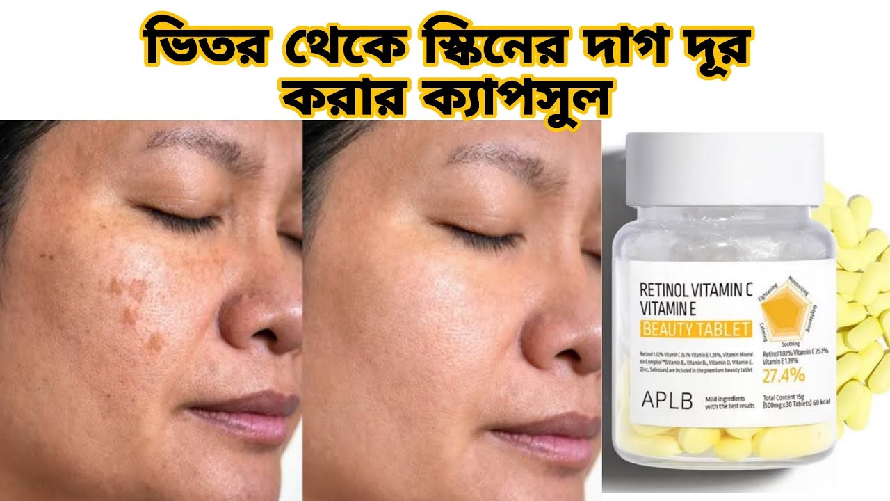 ৭ দিনে ত্বকের সব দাগ গায়ের হয়ে যাবে | APLB Retinol Vitamin C Vitamin E Beauty VITAMIN | khadijabegum