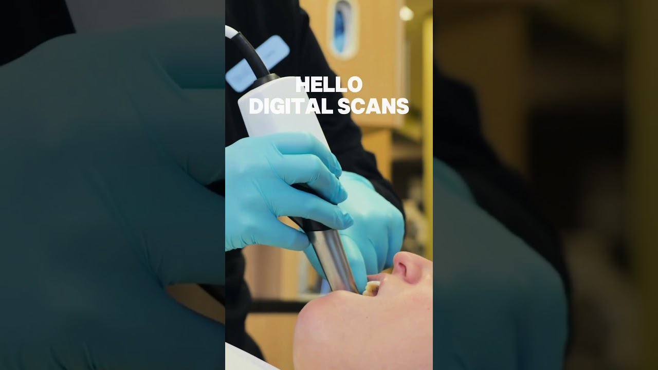 Messy Dental Impressions Are Over (Here’s Why) 🦷✨