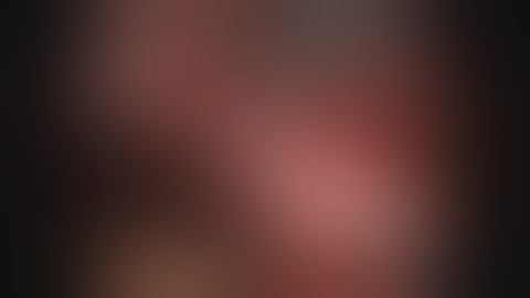 Laparoscopic cholecystectomy (LC) and intraoperative cholangiography (IOC)