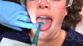 Tongue Suction