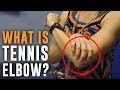 Injury Spotlight: What is Tennis Elbow? Stretches & Exercises