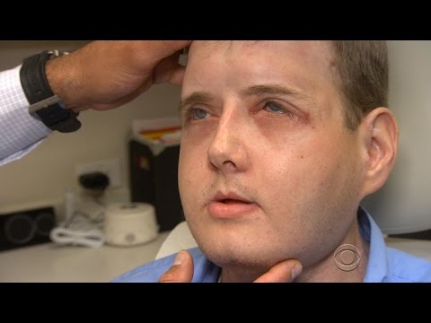 Inside Miami’s deadly plastic surgery industry | Fault Lines Documentary