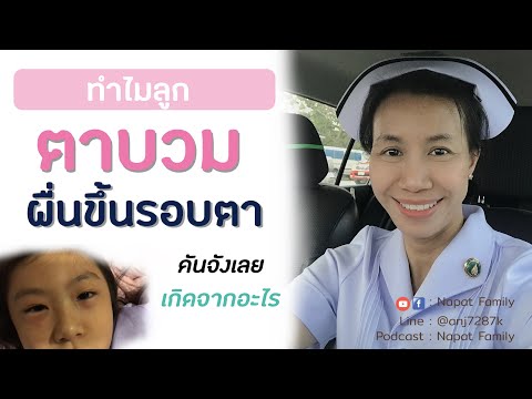 ลูกตาบวม เกิดจากอะไร โรคภูมิแพ้ ? แพ้อาหาร? ดูแลลูกอย่างไรดี