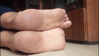 Wrinkled Soles With Imprints