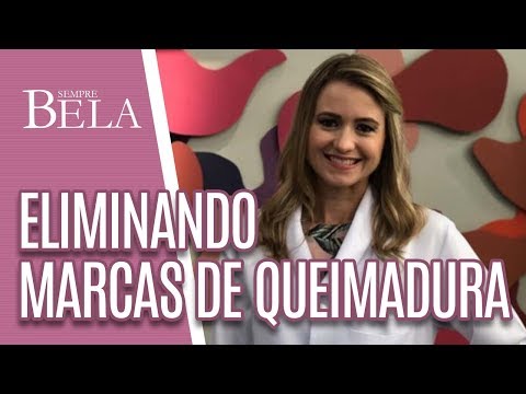Como eliminar marcas de queimadura? - Sempre Bela (05/05/19)