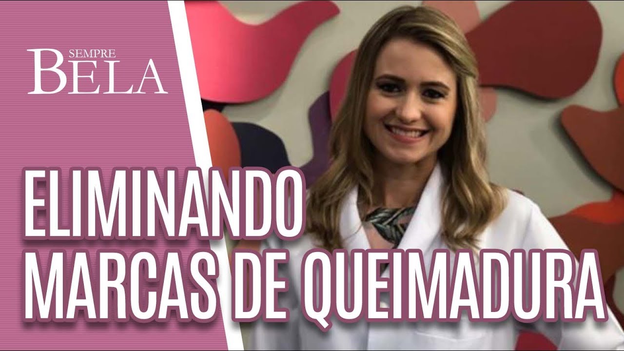 Como eliminar marcas de queimadura? - Sempre Bela (05/05/19)