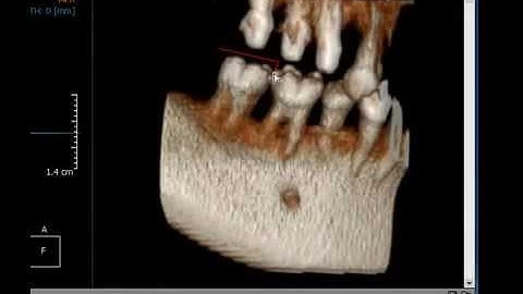 3D Modeule: Segmentation