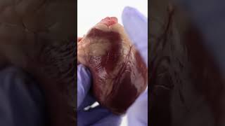 Diferença entre o ventrículo esquerdo e direito do coração!