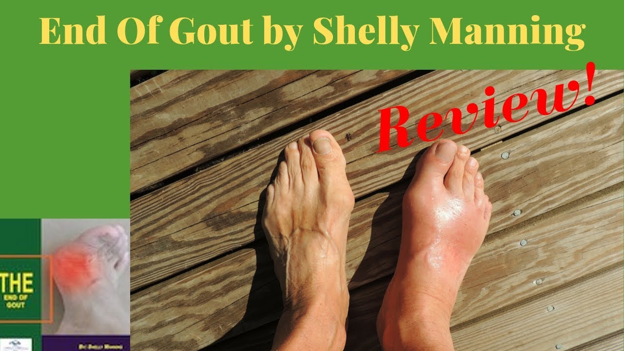Shelly Manning The End Of Gout End of Gout by Shelly Manning ⚠️Don't Buy It Before You Watch This ⚠️
