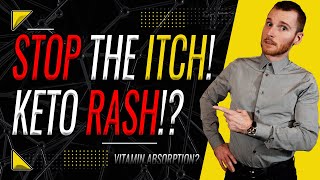 KETO RASH EXPLAINED | A deeper look at the CAUSES and SOLUTIONS!