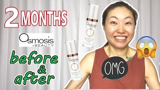 Medical Grade Skincare Brands | I Used Osmosis Skincare for 2 months | Results & more...