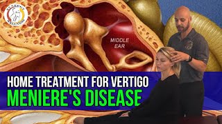 Home Treatment for Vertigo | BPPV |  meniere