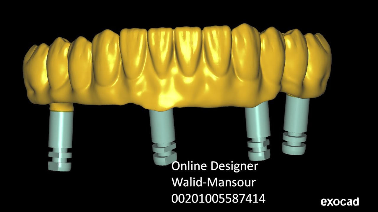 exocad with Walid Mansour 00201005587414 Egypt/Cairo