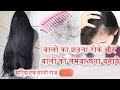 Hair Loss रोकने बालों की ग्रोथ को बढाने वाली और चेहरे को जवां टाइट और ग्लोइंग रखने वाली Supplements