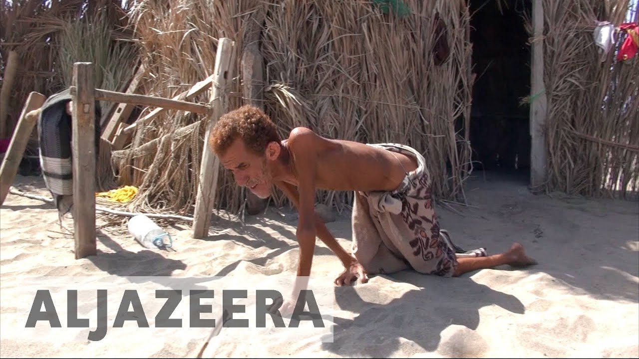 حرب اليمن: الملايين يواجهون الدمار والمرض والمجاعة
