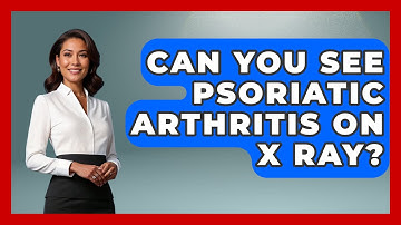 Can You See Psoriatic Arthritis on X Ray? - Orthopedic Support Network