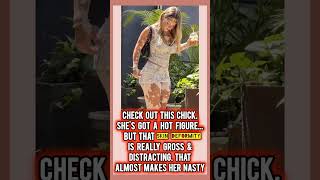 Whats up with this chick's skin? What are your thoughts on her condition?