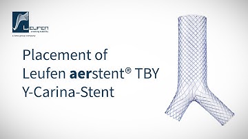 Placement of Leufen aerstent TBY