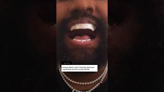 Kanye West Gets Anium Teeth