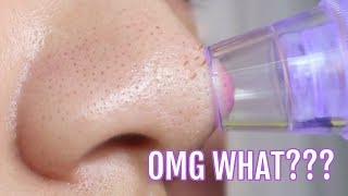 I Didnt Expect That... New Pore + Blackhead Sucking Vacuum! - Youtube