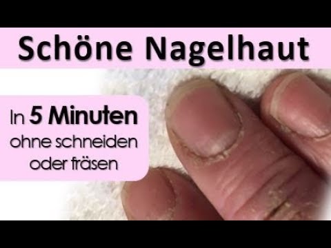 Schöne Nagelhaut in 5 Minuten! OHNE schneiden!