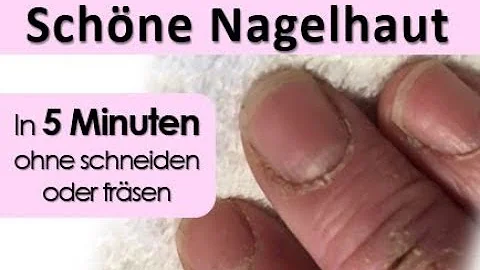 Wie bekomme ich gesunde Nagelhaut?