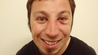 Against the Fence: The Riley Campbell Story - trailer of a 19-minute doc (developmental disability)