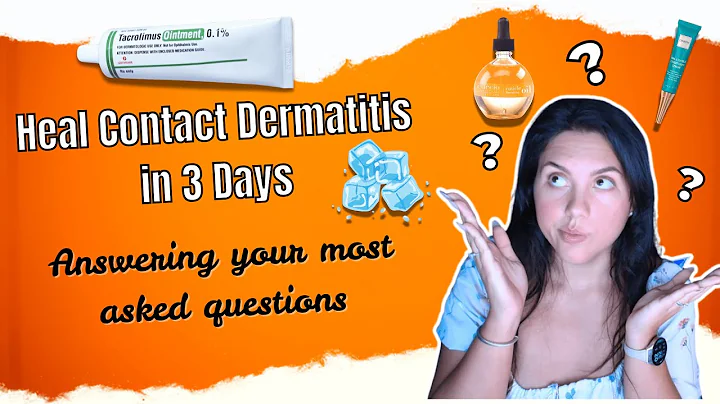 How I Quickly Heal Contact Dermatitis 🩹 | ❓Answering Your Most Asked Questions❓