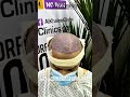 best hair transplant in karachi | MORE THAN 10,000 HAIR TRANSPLANTS DONE!! ALLHAMDULILLAH!! 🏆