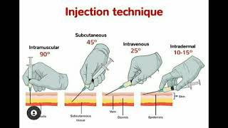 Injection Techniques, "Intermuscular, Subcutaneous, Intravenous, Intradermal". screenshot 1