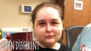 I Went Blind At 15  And NoOne Knows Why | BORN DIFFERENT