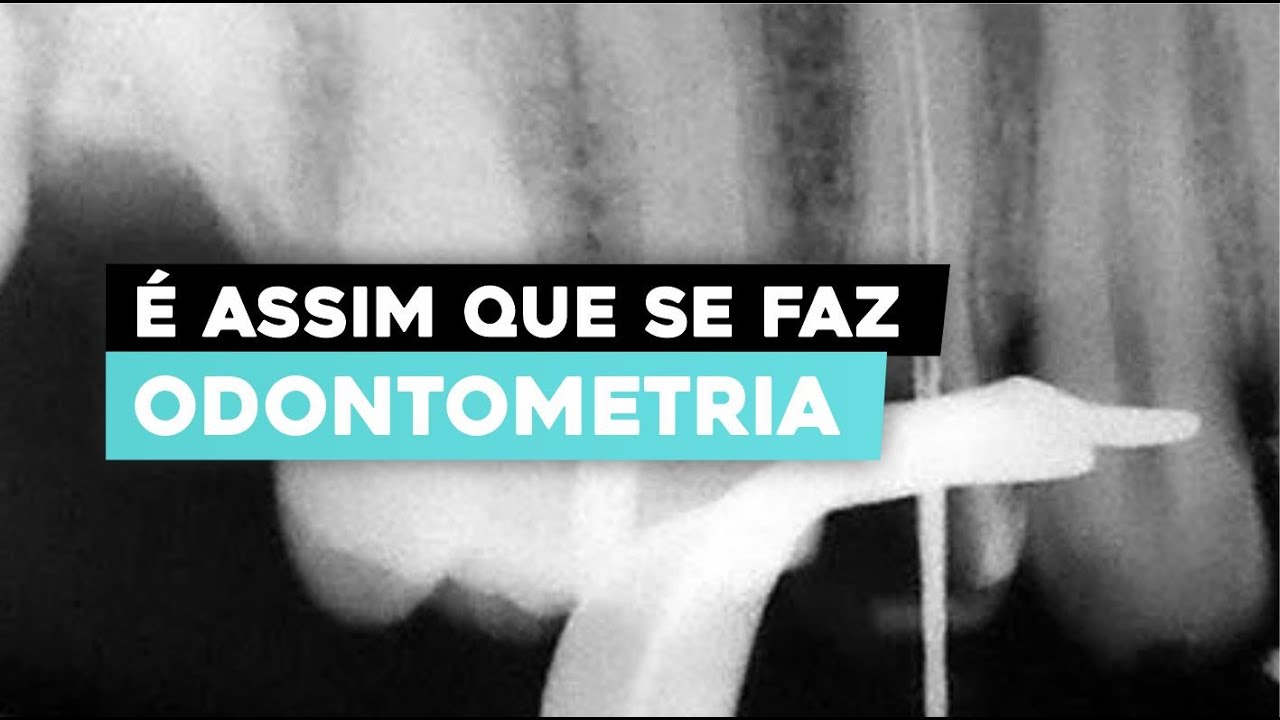 Odontometria de forma simples