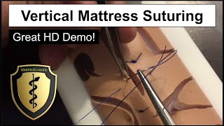 SUTURE Tutorial: Vertical Mattress Suturing Technique- Step-by-step instructions in HD!