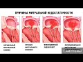 Пролапс митрального клапана. Как лечить пролапс митрального клапана.