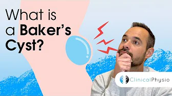 What is a Baker's Cyst?! | Expert physio explains anatomy, diagnosis and treatment of a Bakers Cyst