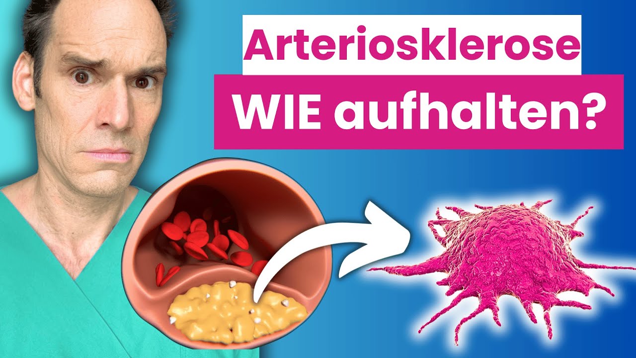 Arteriosklerose erkennen und aufhalten - Die 5 WICHTIGSTEN Werte | Dr. Heart