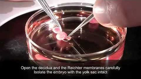 Imaging mouse embryo aorta - Video 3