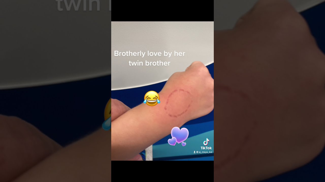 Twin Brother Biting His Sister Bitemark Shorts 