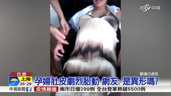 【中视新闻】 孕妇肚皮剧烈胎动 网友: 是异形吗? 20150906 - 天天要闻