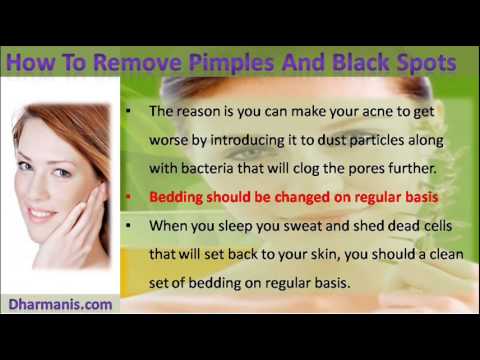 How Can I Remove Pimples And Black Spots On My Face? - YouTube