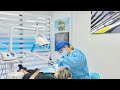 Teeth Cleaning-Dental Blush