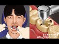 ASMR 환자분 조금만 참으세요~ 충치치료 애니메이션 part2 | 치과 충치제거  | Satisfying caries removal animation | Dental care