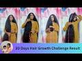 30 நாட்களில் அடர்த்தியாகவும்  நீளமாகவும் முடி வளர  / 30 days hair growth challenge