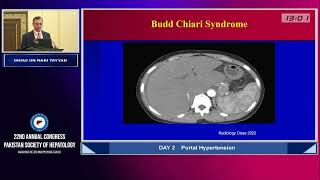 Non Cirrhotic Portal HTN by Dr Ghias Un Nabi Tayyab - PSH 22