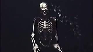 Bones - LookWhatWeHaveHere (legendado)